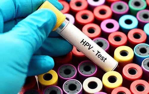 hpv是什么病|hpv病毒有什么症状|hpv病毒能治好吗